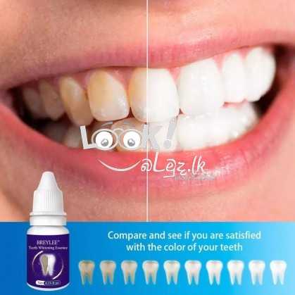 LANBENA Teeth Whitening For Dental treatment 
