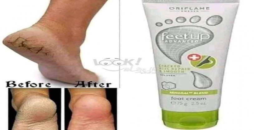 foot cream 